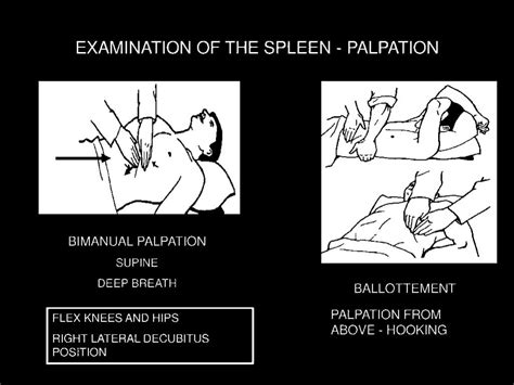 scratch test spleen|how to check for spleen problems.